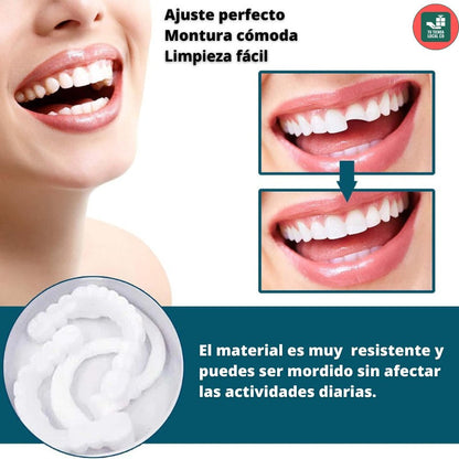 CARILLAS DENTALES GG SNAP ON DENTURE UN CAMBIO QUE TRANSFORMA TU VIDA AL INSTANTE